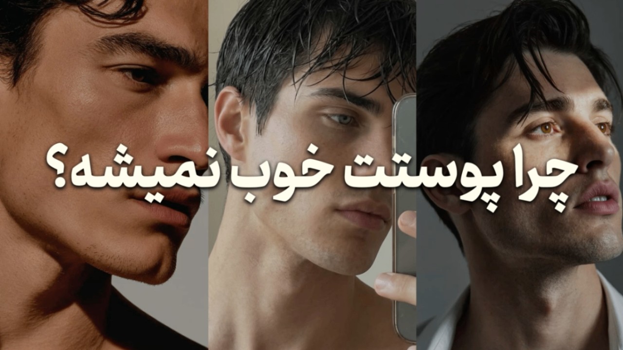 پوستتو مثل آینه کن! ( اشتباهات + راه حل ها )