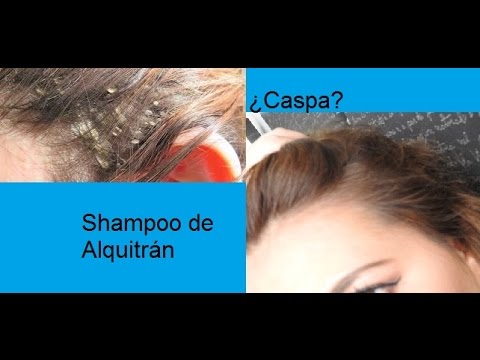 Video: Jabón de alquitrán para rostro y cabello
