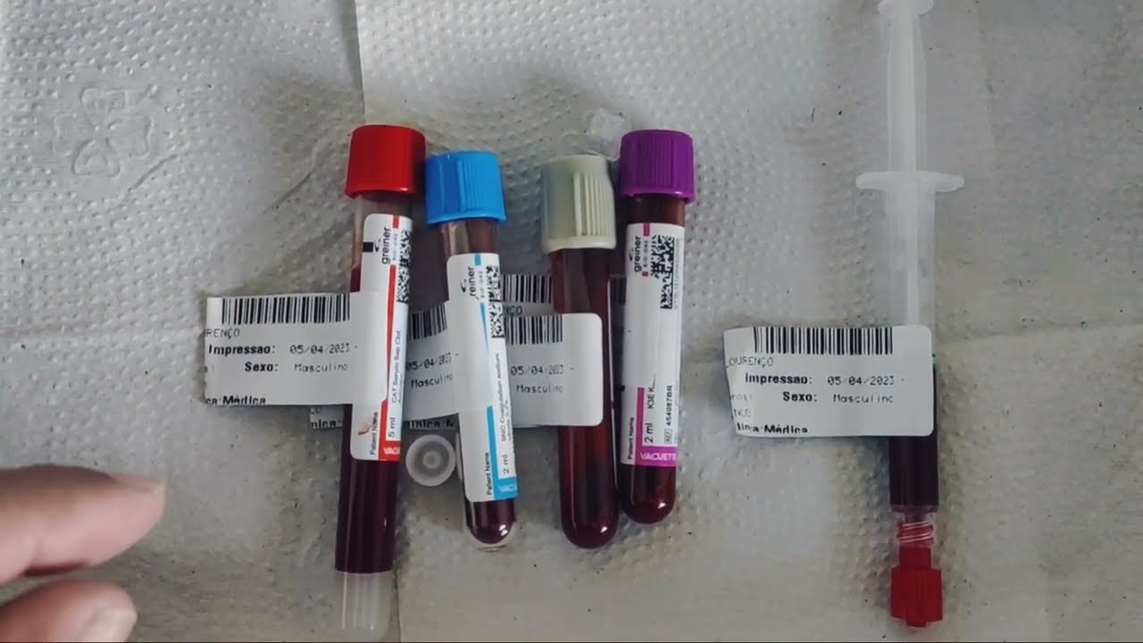 como-feita-a-coleta-de-gasometria-arterial-na-pr-tica-youtube