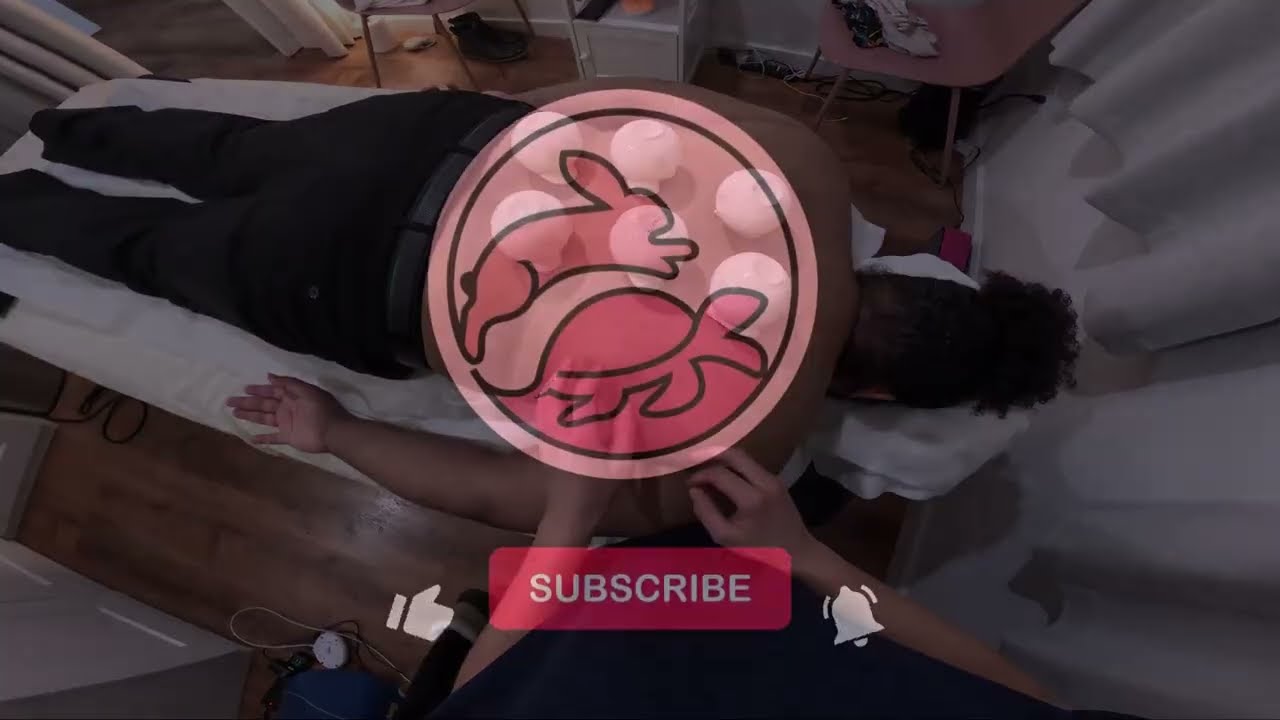 Fire Cupping Therapy