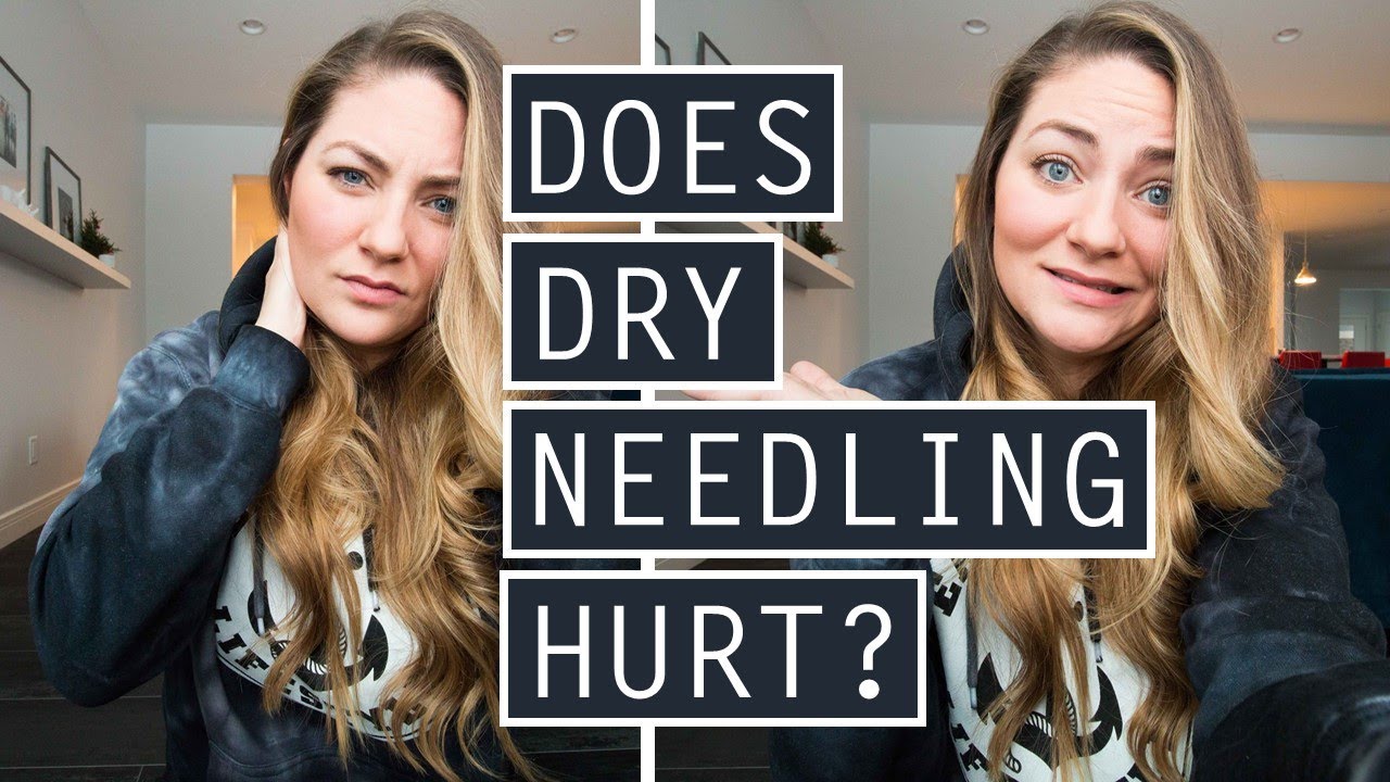 What does dry needling feel like travel and physiotherapy update