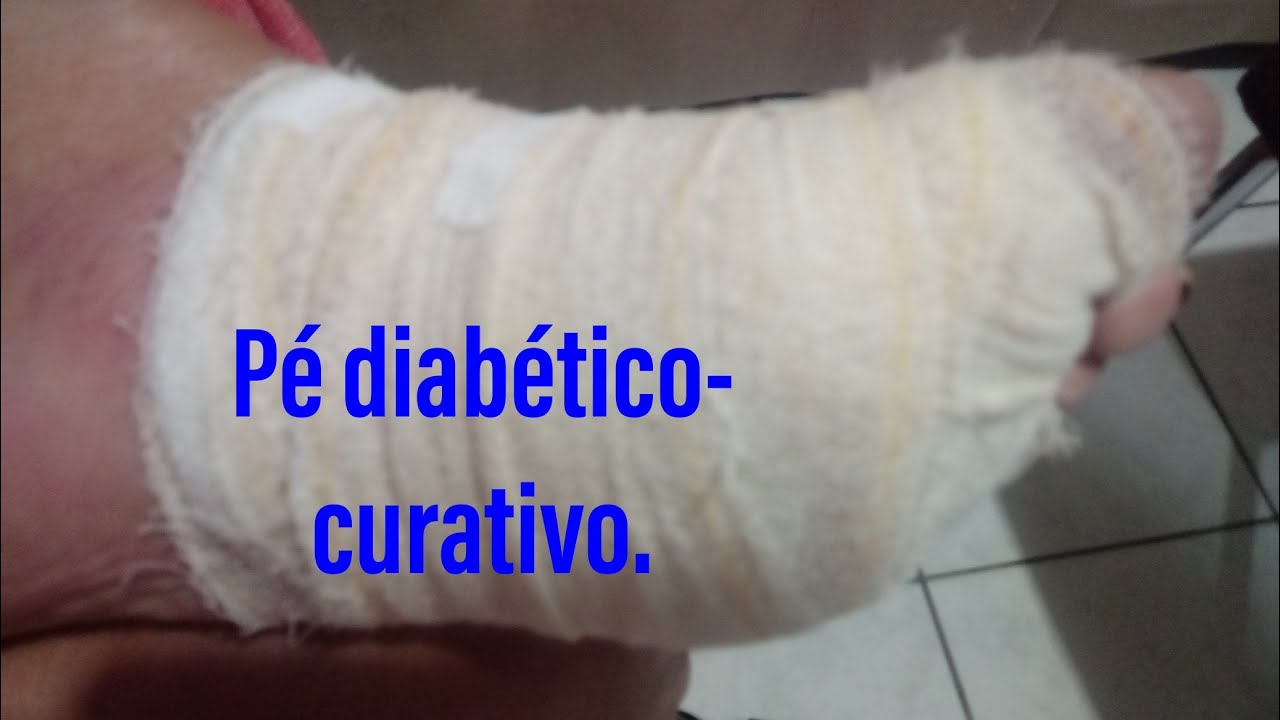 pé diabetico,causa,tratamento camera iphone 8 plus apk