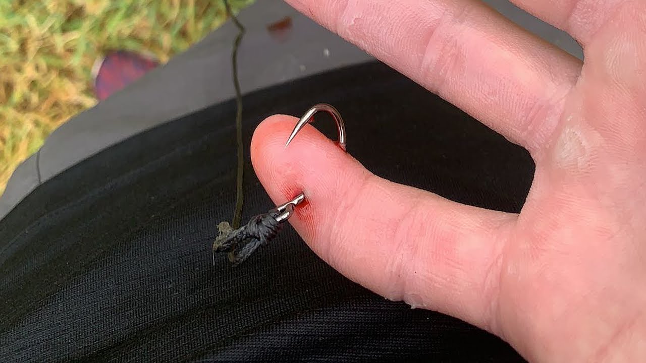 Removing A Fishing Hook From Finger (GRAPHIC) 