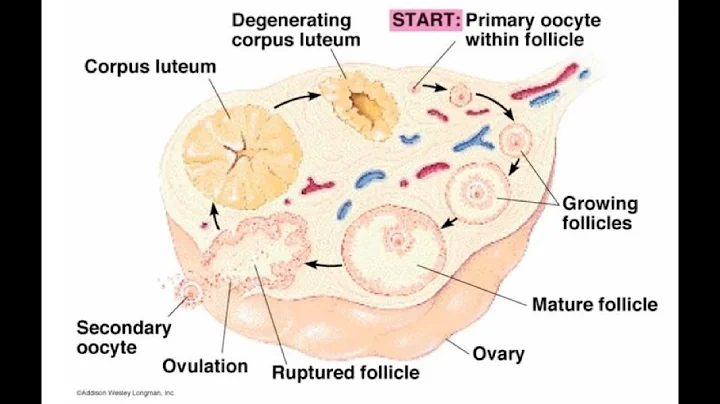Ovarian Cysts - Everything you should know Part 1