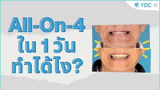 ALL-ON-4 ใน 1 วัน ทำได้ยังไง?