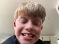 100 subscribers