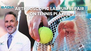 Dr. Badia explains Labrum repair to patient post-op #orthopedics #shoulderpain