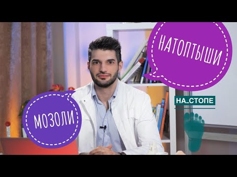 МОЗОЛЬ И НАТОПТЫШ, как лечить #натоптыши #мозоли #плоскостопие