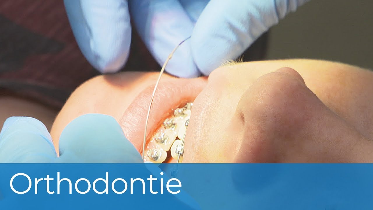 Orthodontie YouTube
