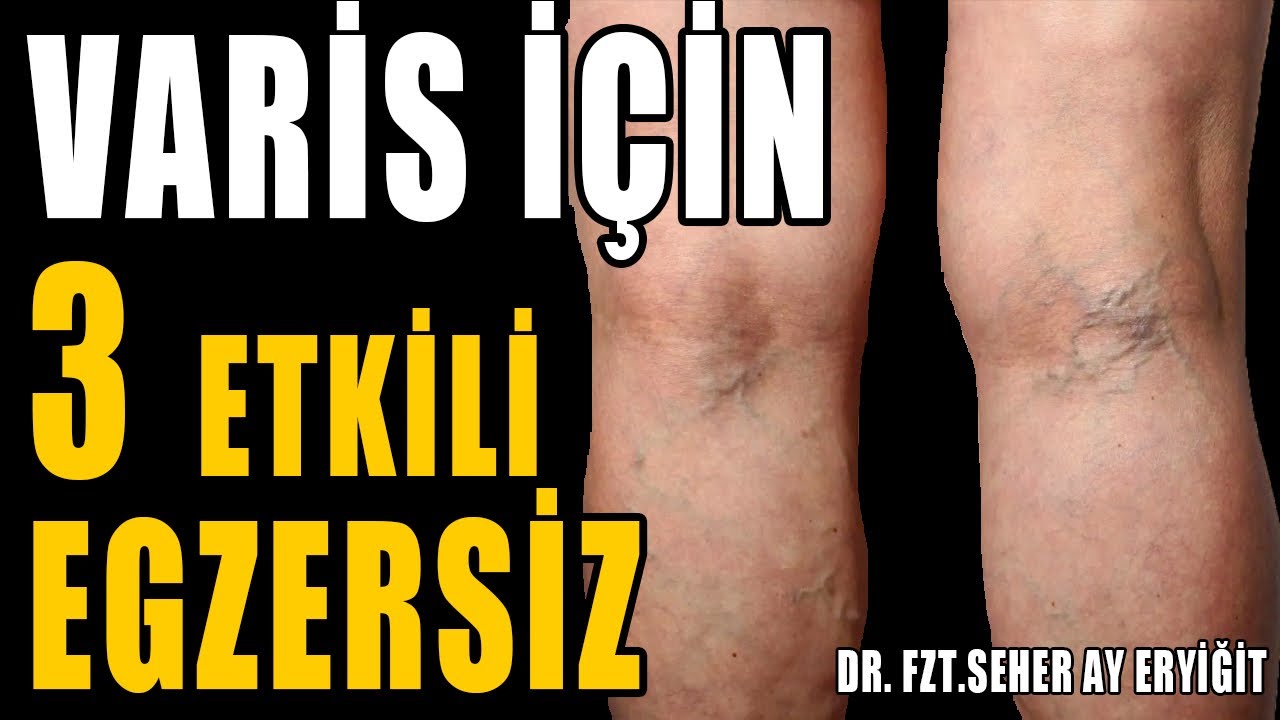 VARİS İÇİN OTURARAK YAPILAN 3 EGZERSİZ #aktifizyo #fiziktedavi #varisu