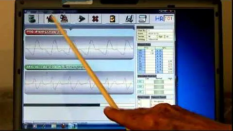 Meridian DPA - Arterial Stiffness Test (PTG)