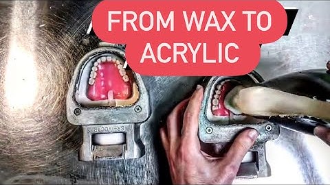 HOW DENTURES ARE MADE (Processing dentures using ivocap injection system) #WAXBAE #DENTURES #IVOCAP