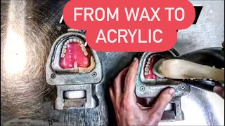 HOW DENTURES ARE MADE (Processing dentures using ivocap injection system) #WAXBAE #DENTURES #IVOCAP