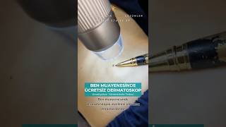 Ben Muayenesi̇nde Ücretsi̇z Dermatoskop İncelemesi̇ -Idea Klinik