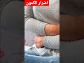 اضرار الكمون Shorts 