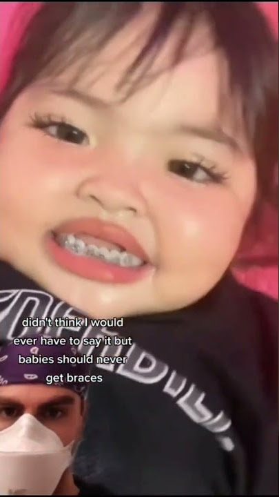 BABY With Braces 😥