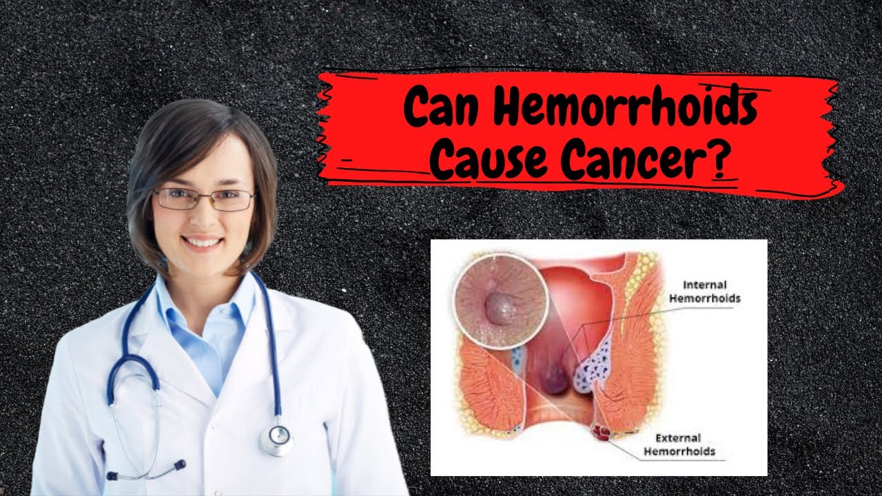 Can Hemorrhoids Cause Cancer? Comparing their Symptoms - YouTube