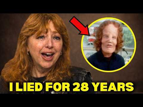 Before She Died, Rocky Dennis's Mom FINALLY Broke Silence About Rocky Dennis And It's BAD