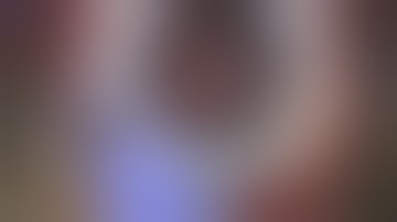 Yamane Technique of Intrascleral Haptic Fixation -Dr Sheetal Brar