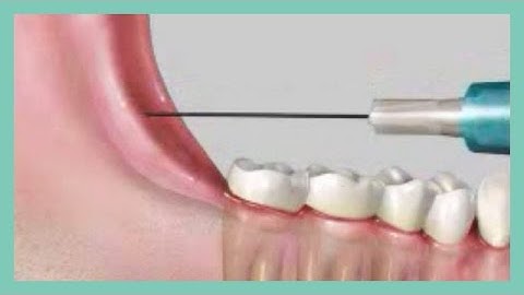 The Wand Mandibular Injection Tutorial