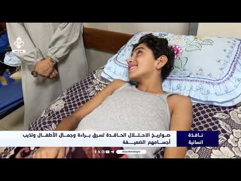 صاروخ غادر بيد احتلال مجرم يحو ل الطفل محمد حلس من لاعب موهوب إلى طفل مشلول