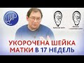 Укорочение шейки матки в 17 недель. Истмико-цервикальная недостаточность (ИЦН) Причина, что делать?