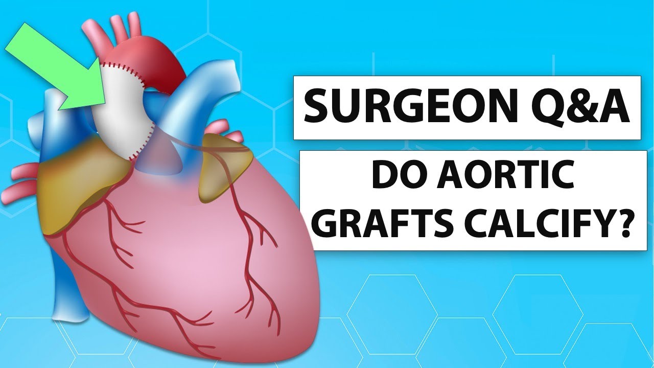 Surgeon Q&A: Can Dacron Grafts Calcify After Bicuspid Aortic Valve