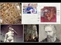 Michelangelo the Anatomist:  Brains & Kidneys on the Ceiling!