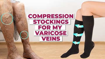 Do Compression Socks Really Help Varicose Veins? | How to Choose the Right Ones?