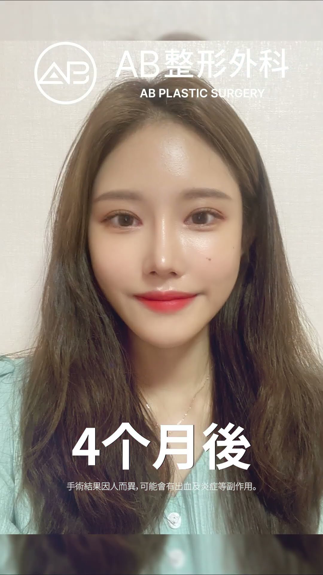 美麗蛻變：眼睛與鼻子的驚人變化！ #热门 #推荐