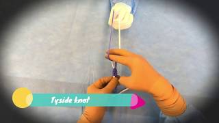 Laparoscopic Tayside Knot