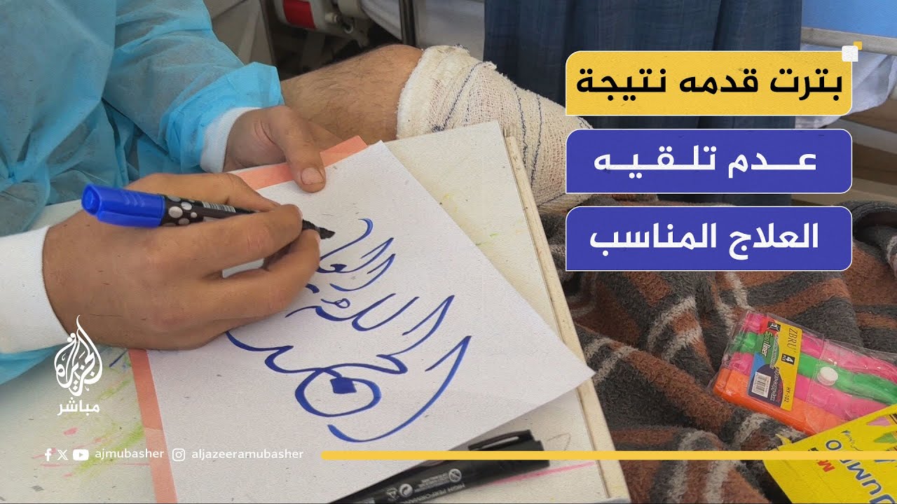 رغم بتر قدمه.. يخط بيديه الأمل على سرير المستشفى