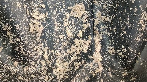 Crazy Beard Dandruff | Dandruff Scratching