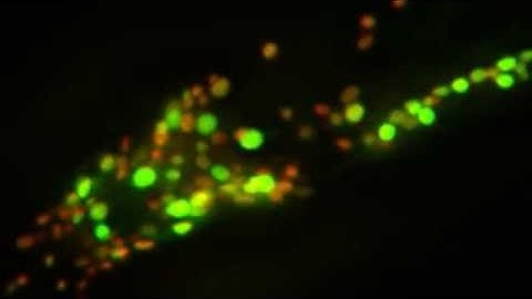 Brain activity imaged with genetically-encoded calcium probe