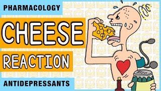 Cheese Reaction Pharmacology