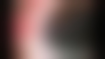 Chang Siepser Knot for IOL Fixation