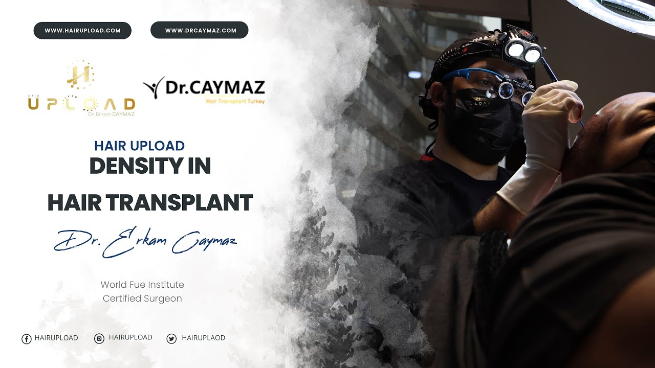 Density in hair transplant