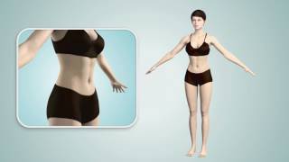 Lutronic enCurve Fat Removal Patient Video