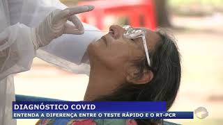 Entenda a diferença entre o teste rápido e o RT-PCR para detecção da covid