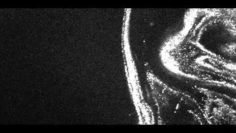 Quantum vortices in Superfluid Helium