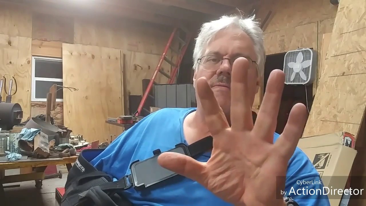 5 Weeks After Rotator Cuff Surgery and Back to Work