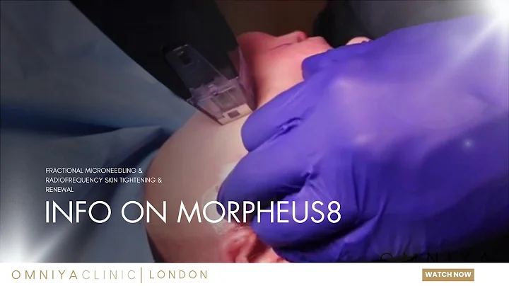 Morpheus8 Fractional Microneedling & Radiofrequency Omniya Clinic London | Skin Tightening & Renewal