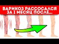 Чистые ножки и легкость! 3 простых народных средства от любой стадии варикоза