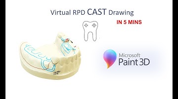 Virtual Cast RPD Drawing in 5 mins