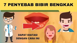 Bibir Tiba-tiba Bengkak? Cari Tahu Penyebabnya
