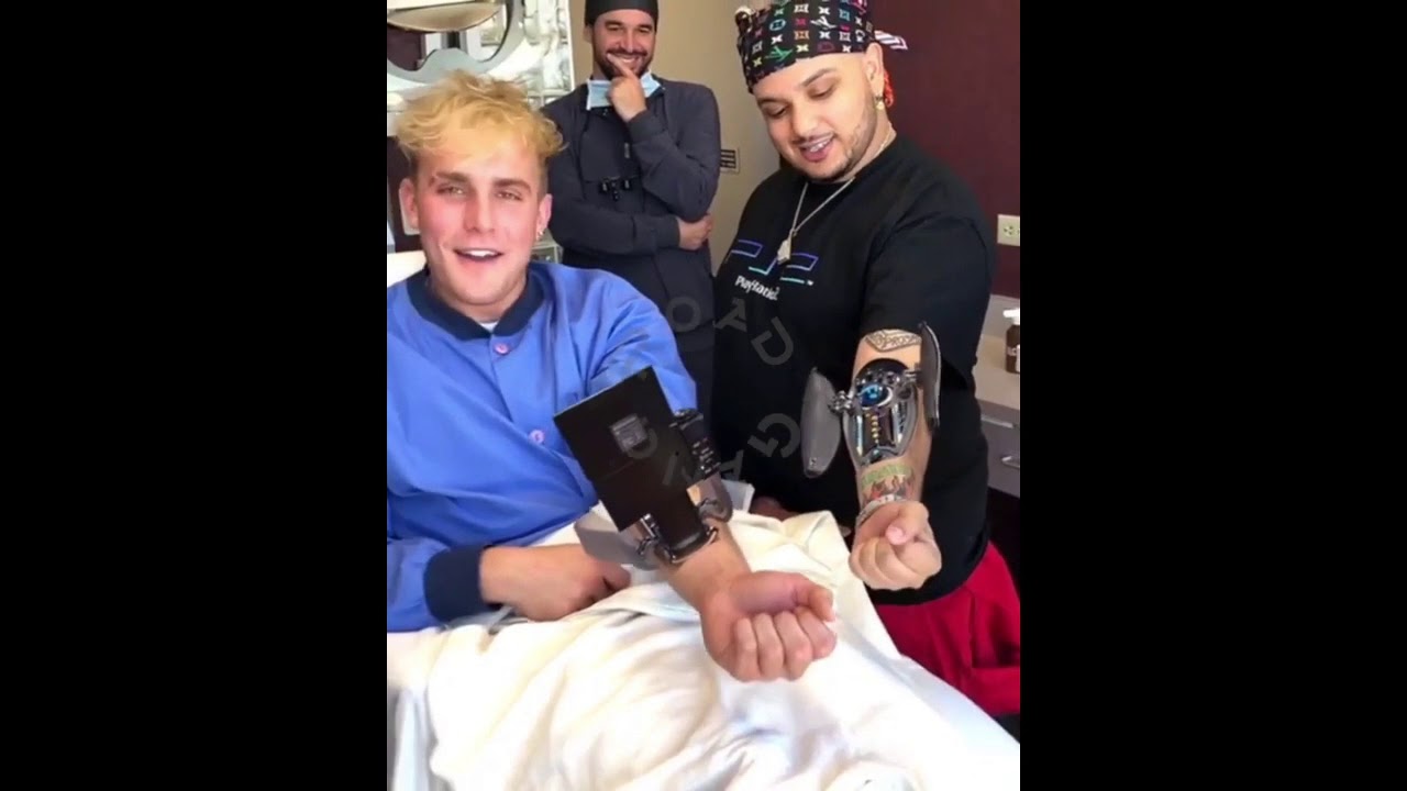 Jake Paul gets a vlog camera implanted in his arm! jake paul, Vlog Came...