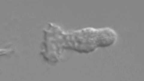 16 7 Chemotaxis of Neutrophils