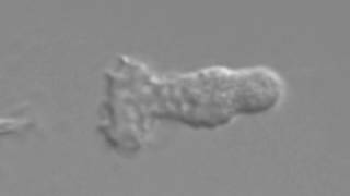 16 7 Chemotaxis of Neutrophils