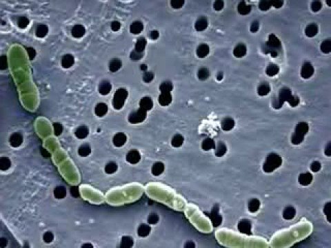 Video: Bakterie Jí Maso A Hurikán Harvey