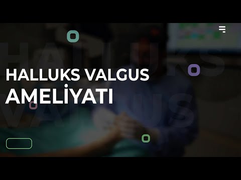 Halluks Valgus Ameliyatı - Ortopedi ve Travmatoloji Uzmanı Op. Dr. Özgür Oktay Nar